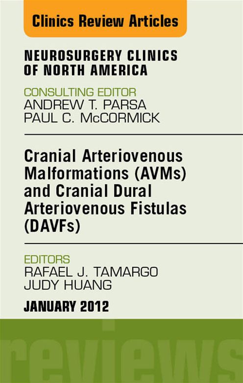 Cranial Arteriovenous Malformations (AVMs) and Cranial Dural Arteriovenous Fistulas (DAVFs), An Issue of Neurosurgery Clinics - E-Book