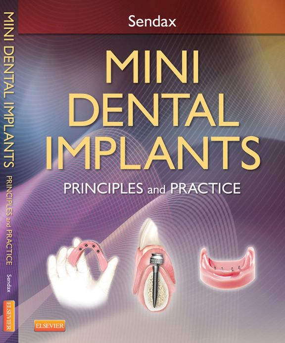 Mini Dental Implants - E-Book: Principles and Practices