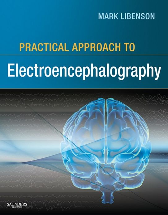 Practical Approach to Electroencephalography E-Book