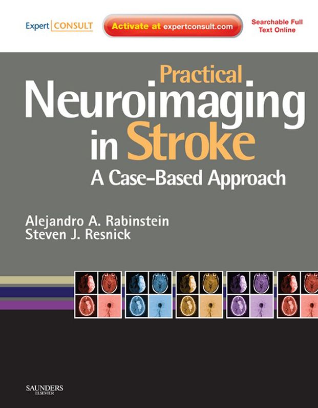 Practical Neuroimaging in Stroke E-Book: A Case-Based Approach