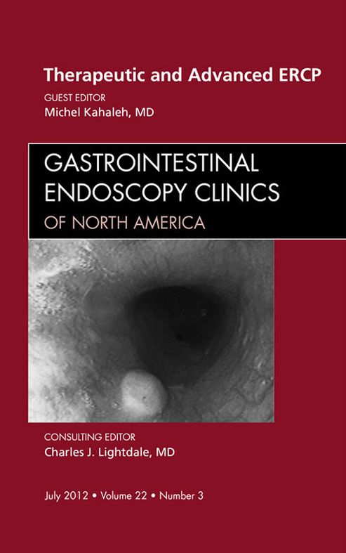 Asthma, An Issue of Clinics in Chest Medicine - E-Book