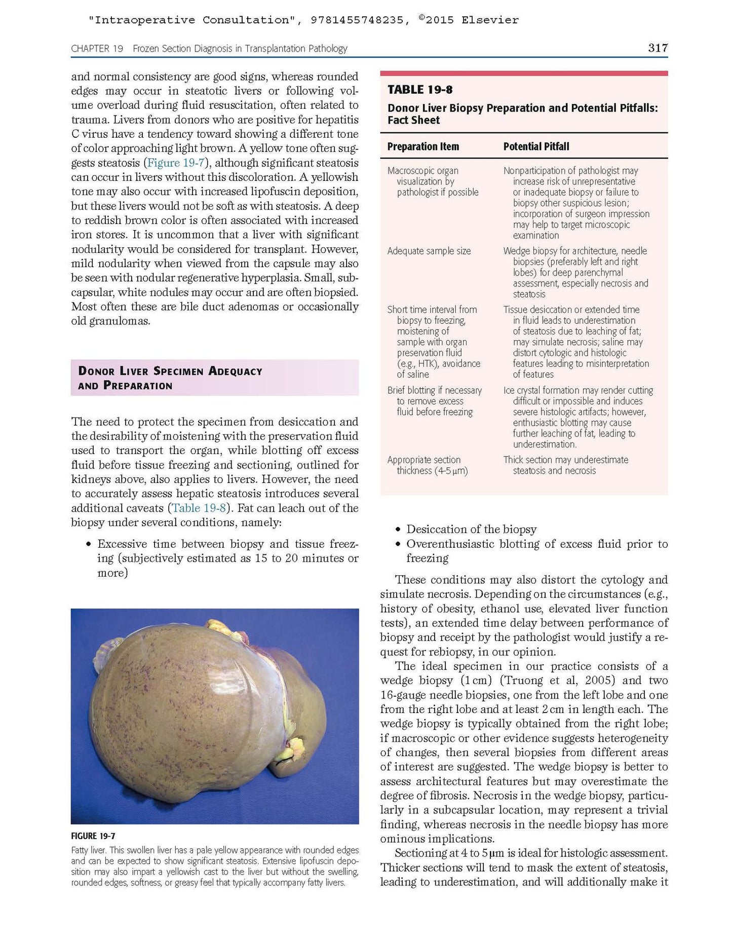Intraoperative Consultation