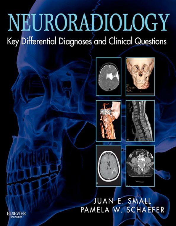 Neuroradiology: Key Differential Diagnoses and Clinical Questions E-Book