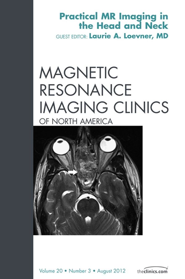 Head and Neck MRI, An Issue of Magnetic Resonance Imaging Clinics - E-Book