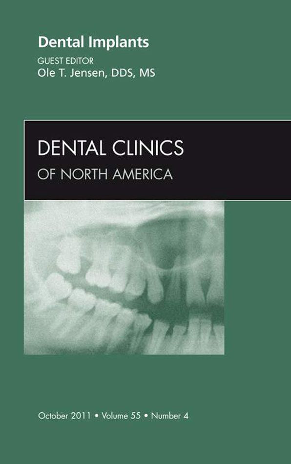 Dental Implants, An Issue of Dental Clinics - E-Book