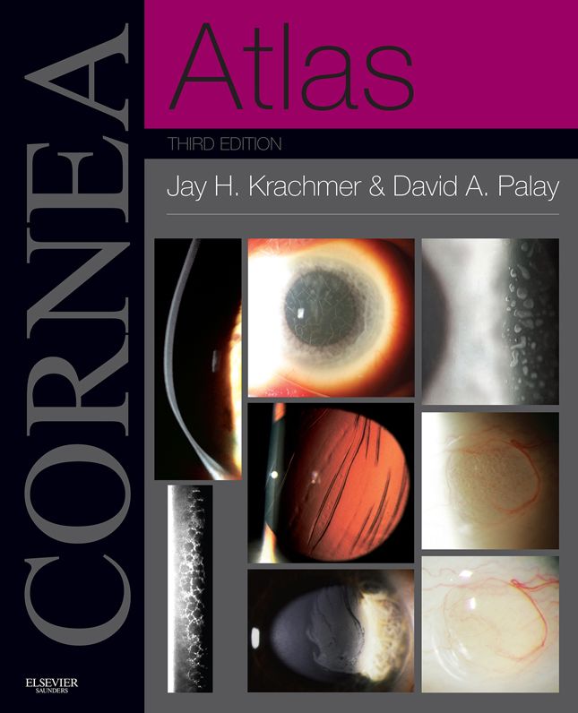 Cornea Atlas E-Book