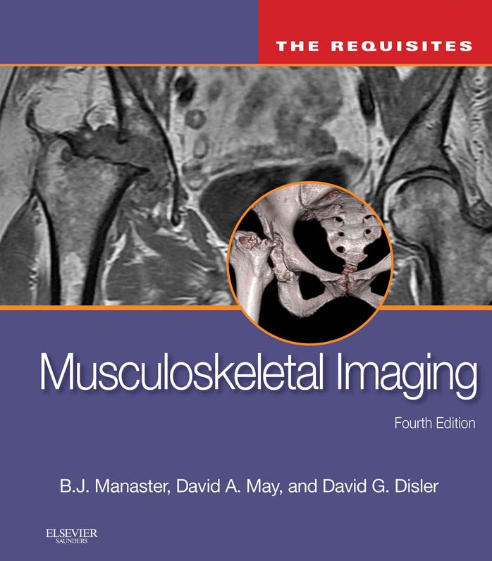Musculoskeletal Imaging: The Requisites E-Book