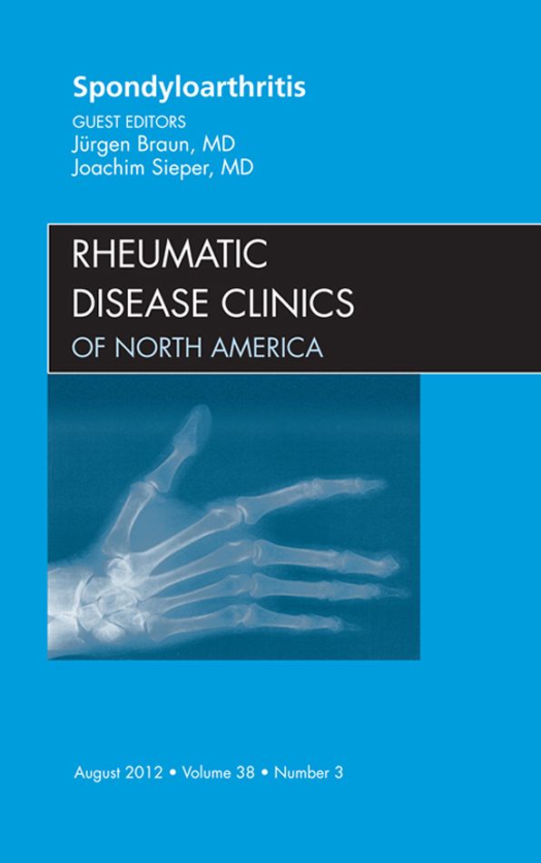 Spondyloarthropathies, An Issue of Rheumatic Disease Clinics - E-Book