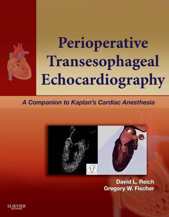 Perioperative Transesophageal Echocardiography E-Book: A Companion to Kaplan's Cardiac Anesthesia (Expert Consult: Online)