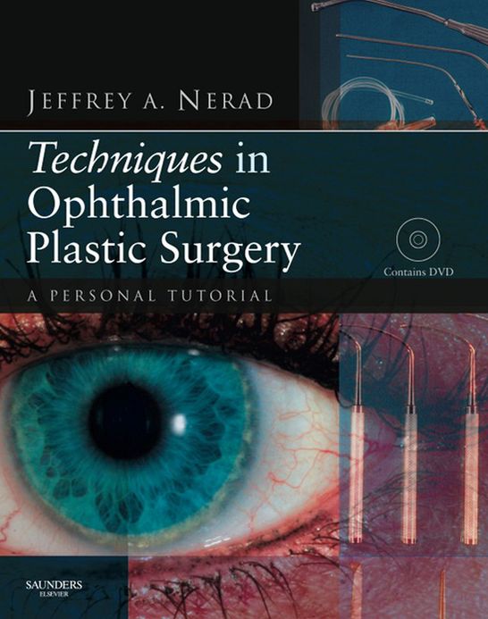 Techniques in Ophthalmic Plastic Surgery - E-Book: A Personal Tutorial