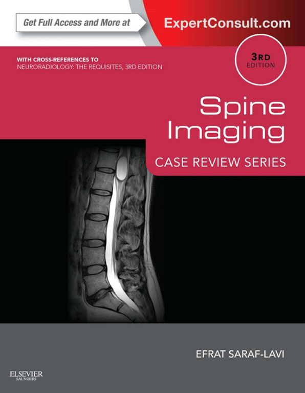 Spine Imaging E-Book: Case Review Series (Expert Consult - Online)