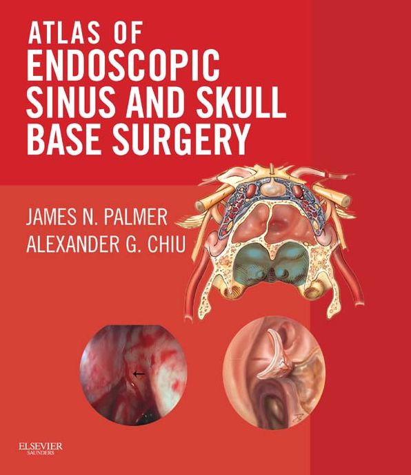 Atlas of Endoscopic Sinus and Skull Base Surgery E-Book