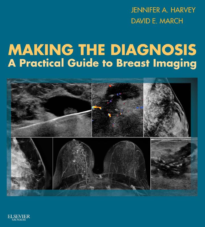 Making the Diagnosis: A Practical Guide to Breast Imaging E-Book