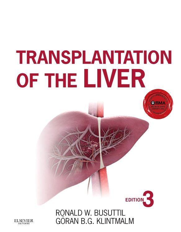 Transplantation of the Liver E-Book