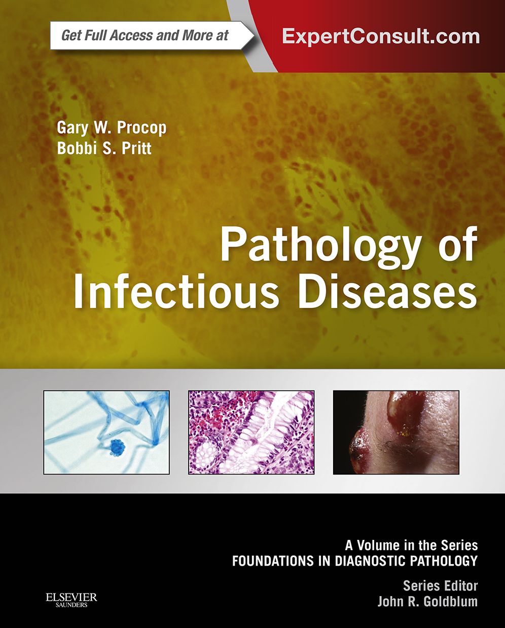 Pathology of Infectious Diseases E-Book: A Volume in the Series: Foundations in Diagnostic Pathology