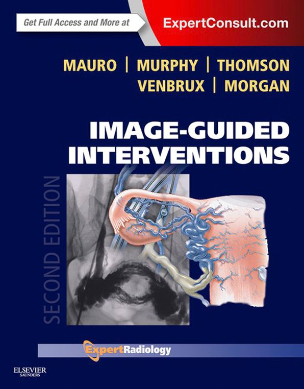 Image-Guided Interventions E-Book: Expert Radiology Series