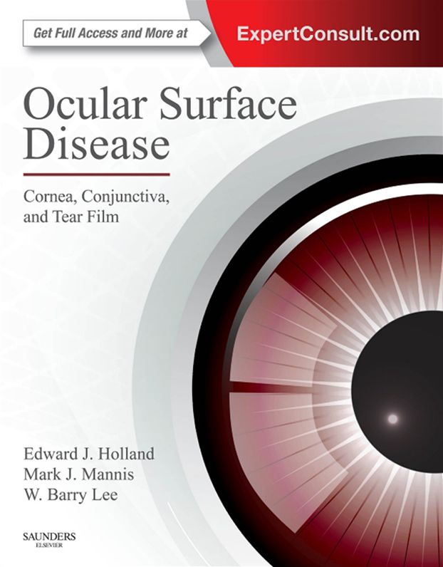 Ocular Surface Disease: Cornea, Conjunctiva and Tear Film E-Book: Expert Consult - Online and Print