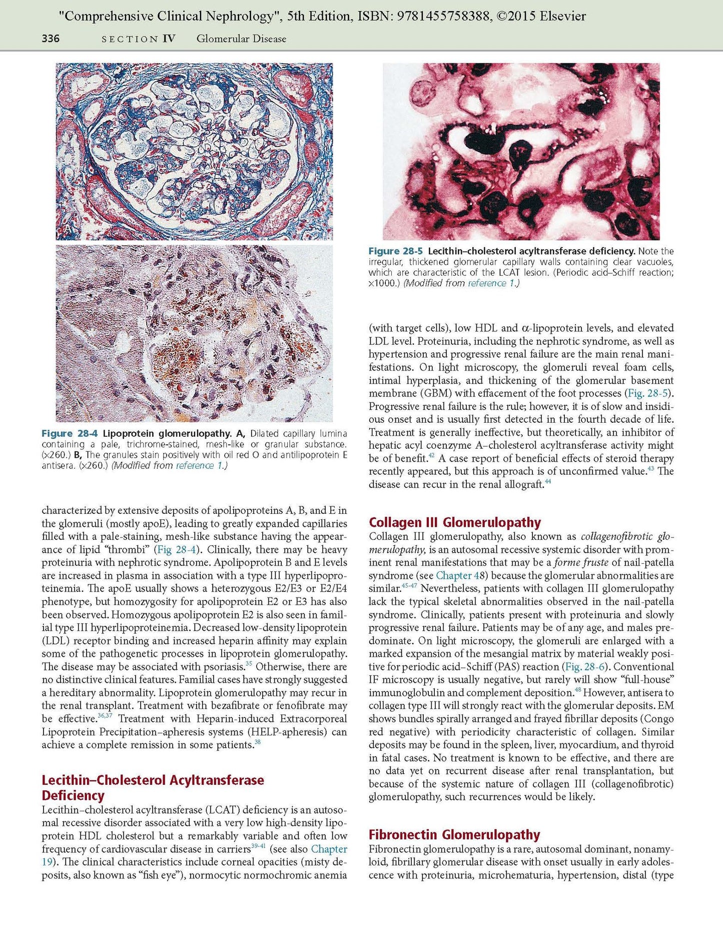 Comprehensive Clinical Nephrology