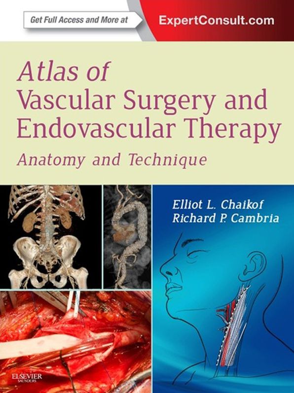Atlas of Vascular Surgery and Endovascular Therapy E-Book: Anatomy and Technique