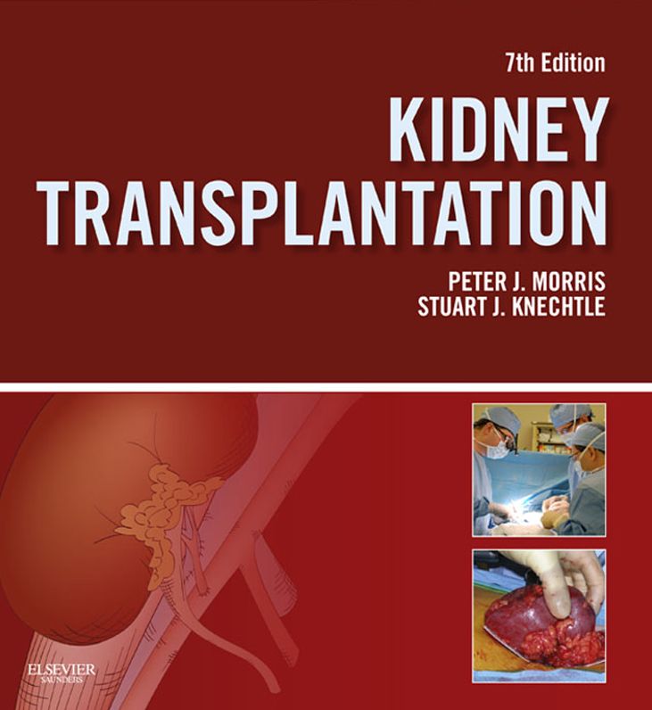 Kidney Transplantation - Principles and Practice E-Book