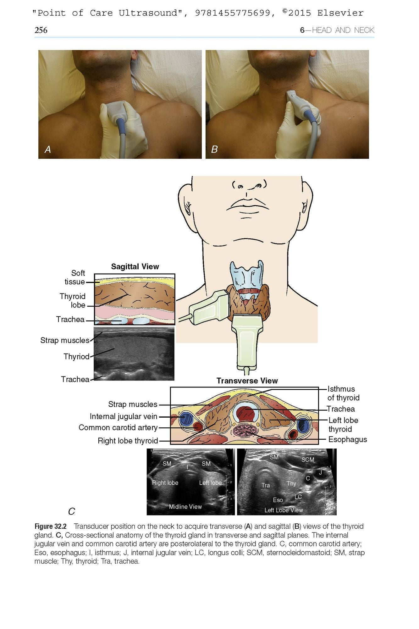 Point-of-Care Ultrasound