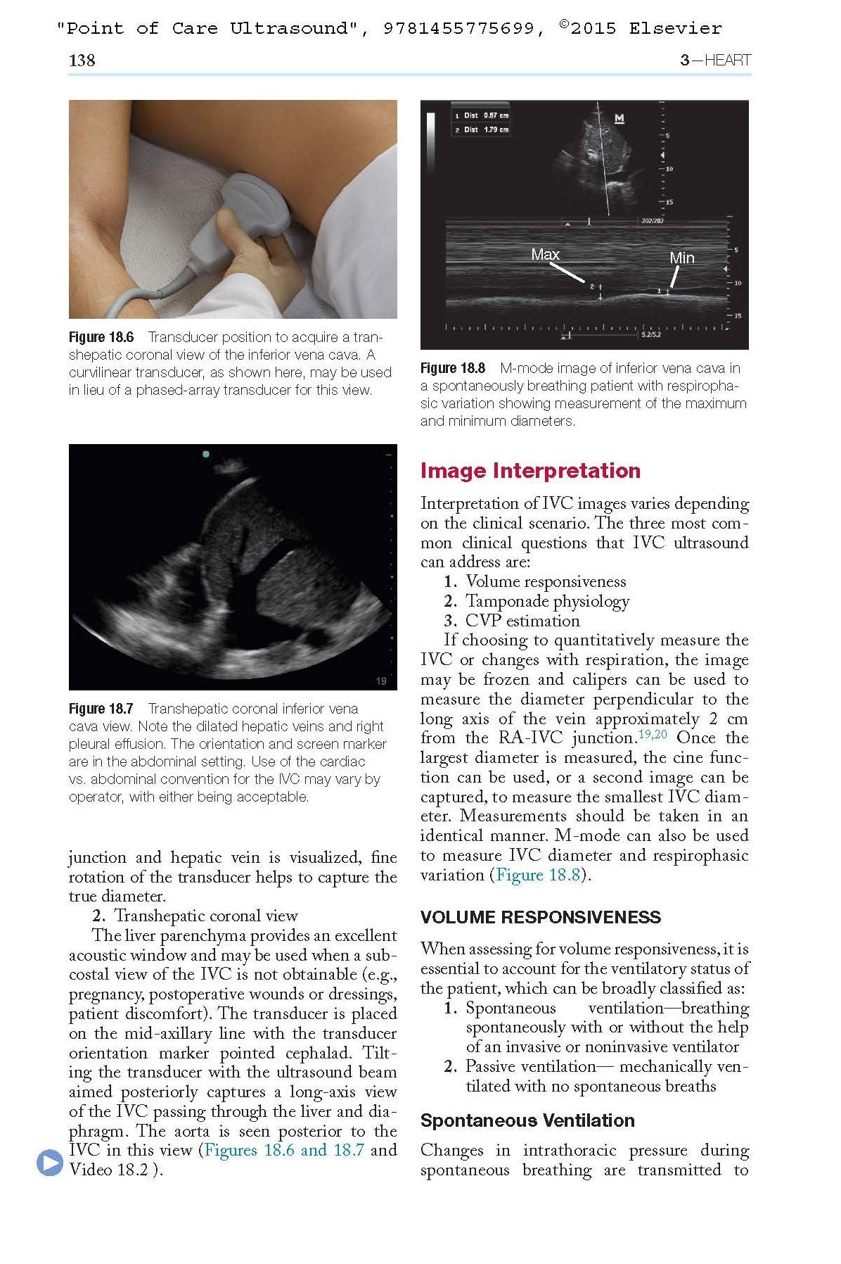 Point-of-Care Ultrasound