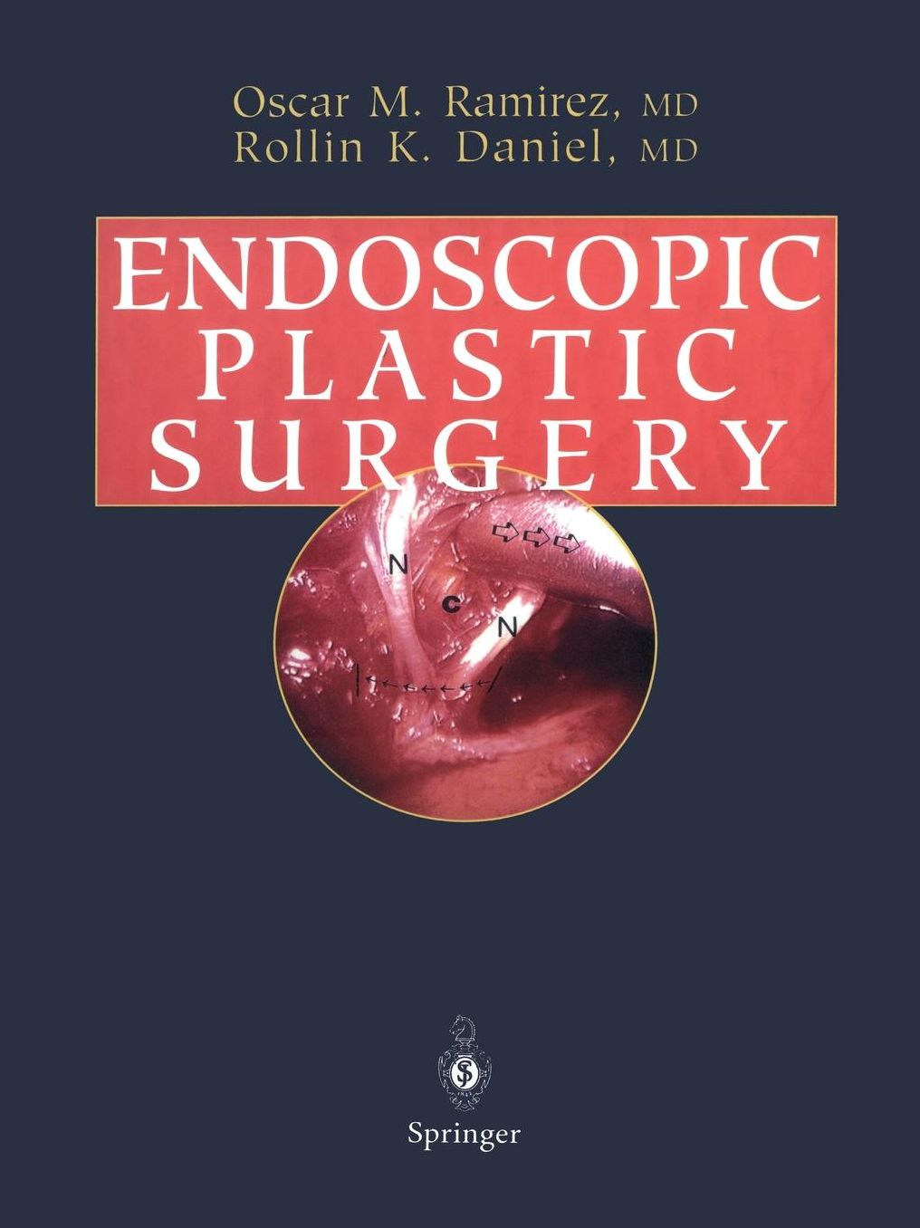 Endoscopic Plastic Surgery