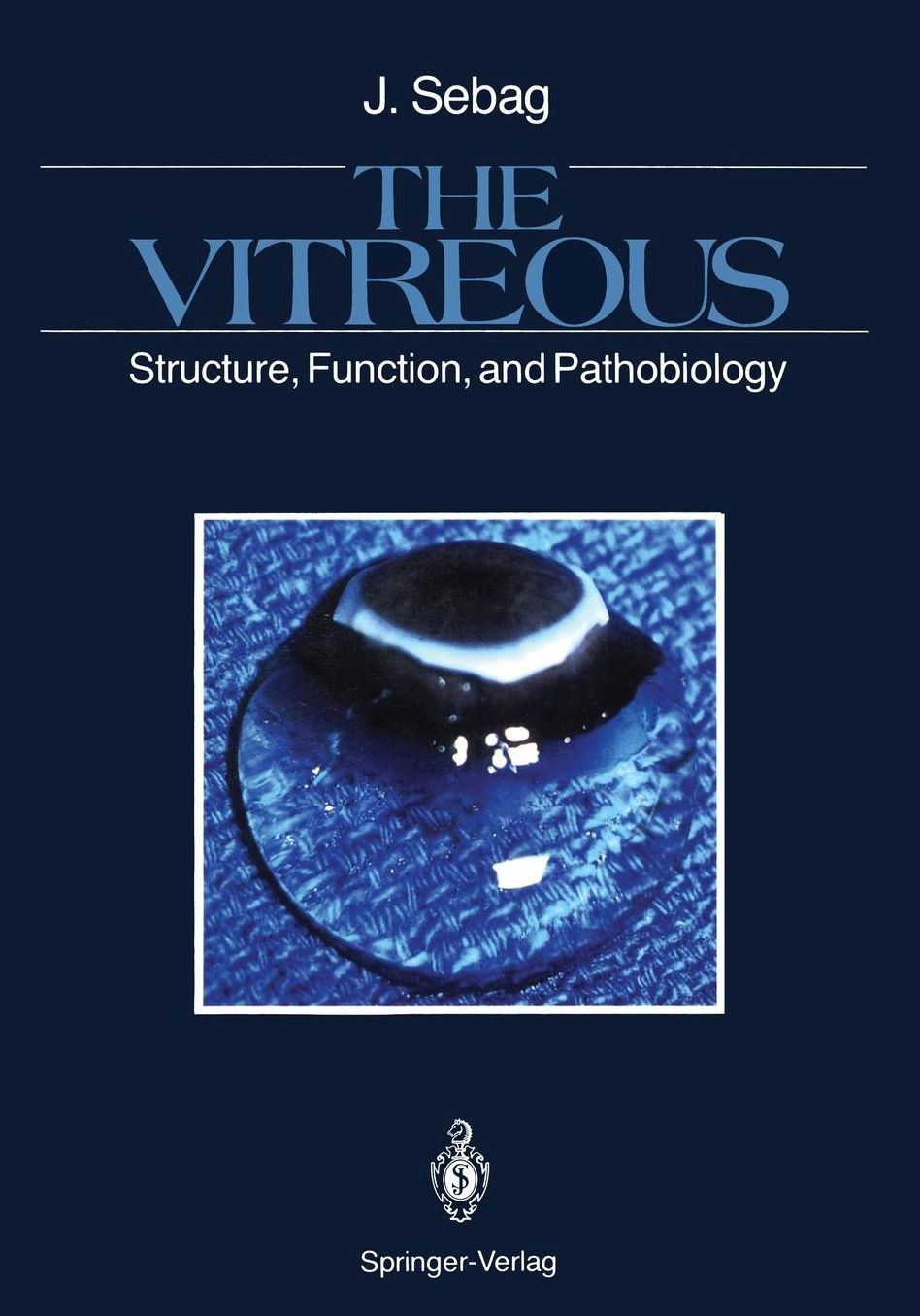 The Vitreous: Structure, Function, and Pathobiology