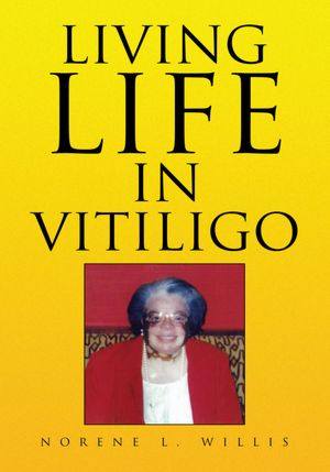Living Life In Vitiligo
