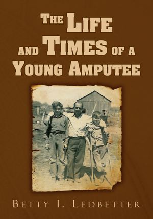 The Life And Times Of A Young Amputee