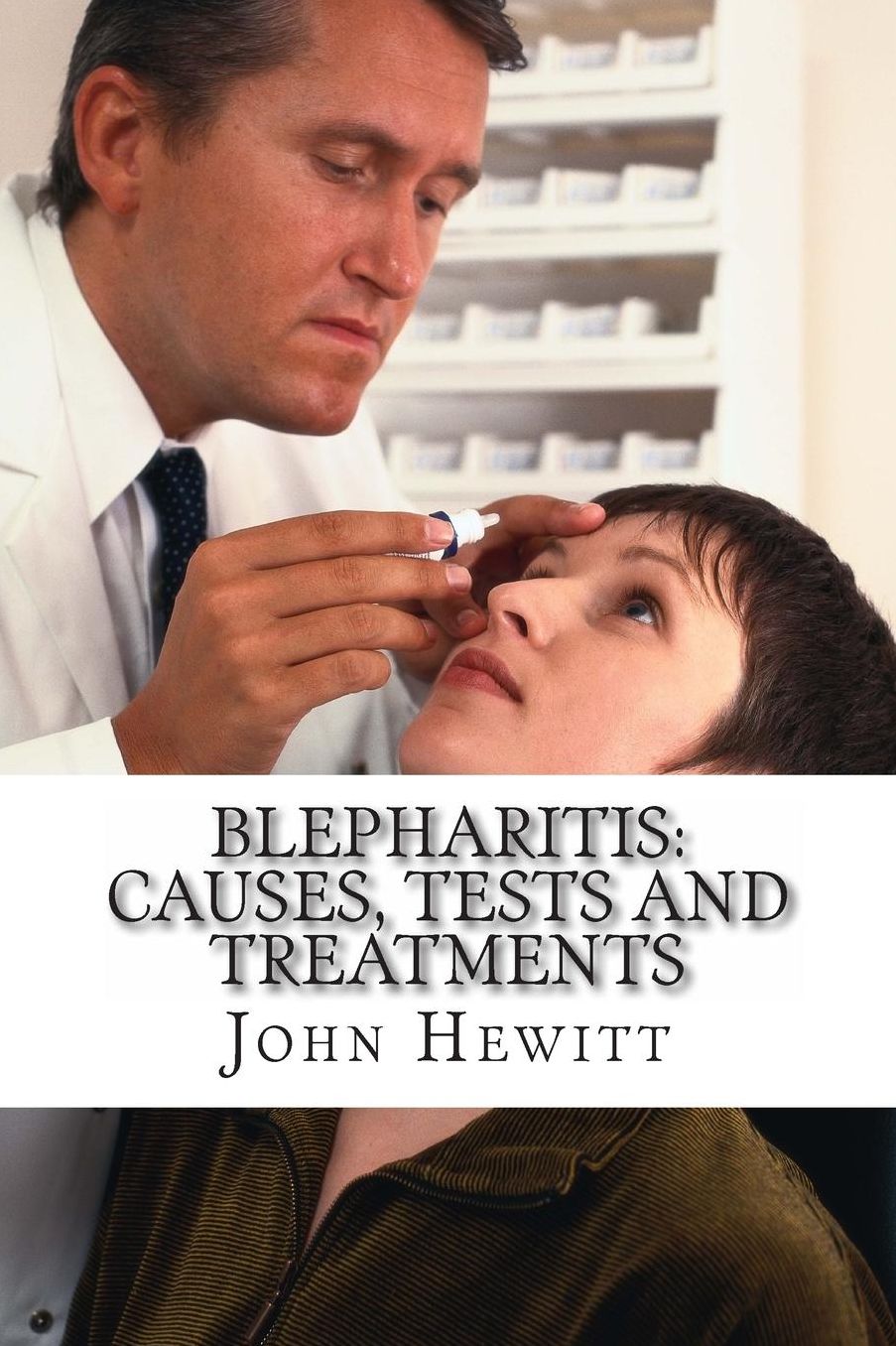Blepharitis: Causes, Tests and Treatment