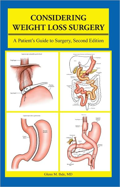 Considering Weight Loss Surgery: A Patient's Guide to Surgery, Second Edition