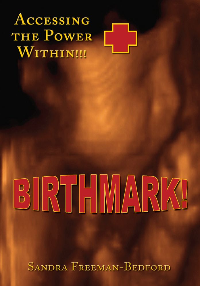 Birthmark!: Accessing the Power Within