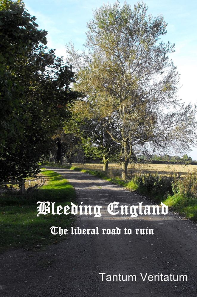 Bleeding England: The liberal road to ruin