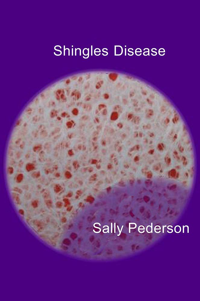 Shingles Disease
