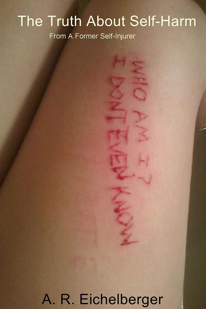 The Truth About Self-Harm: From A Former Self-Injurer