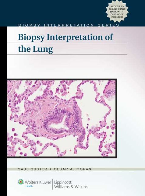 Biopsy Interpretation of the Lung