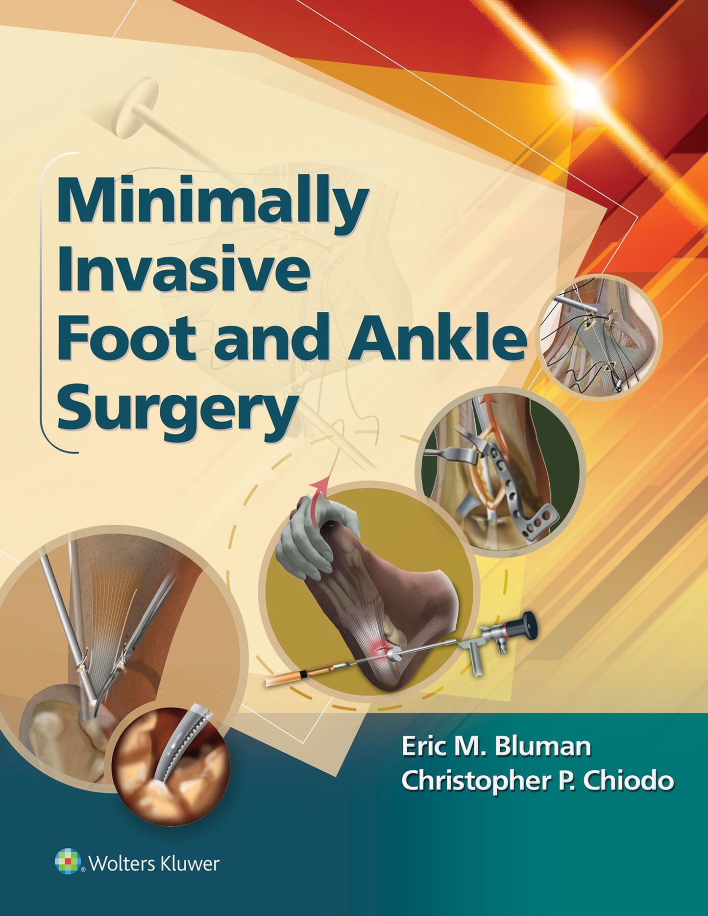 Minimally Invasive Foot & Ankle Surgery