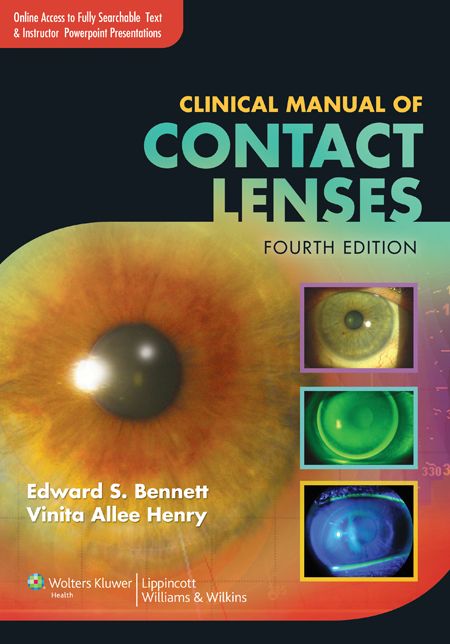Clinical Manual of Contact Lenses
