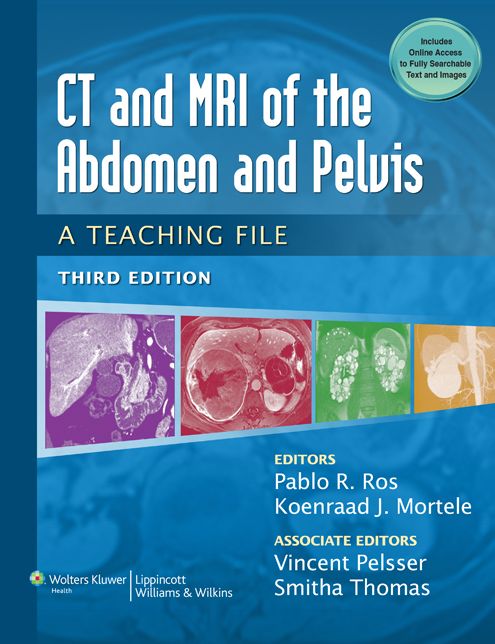 CT & MRI of the Abdomen and Pelvis: A Teaching File: A Teaching File