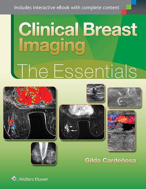 Clinical Breast Imaging: The Essentials: The Essentials