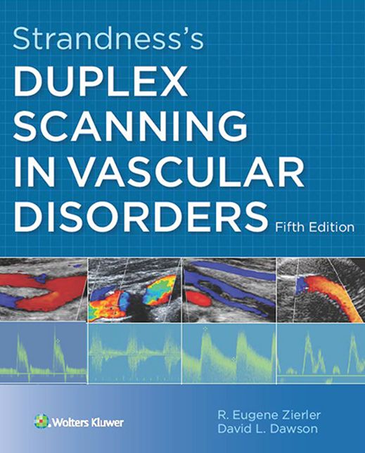 Strandness's Duplex Scanning in Vascular Disorders