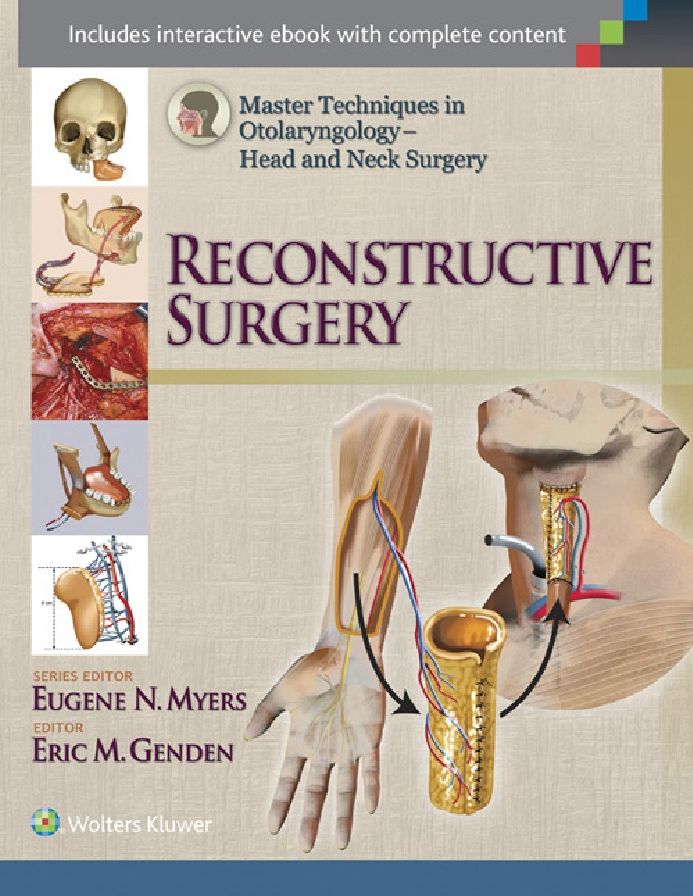 Master Techniques in Otolaryngology - Head and Neck Surgery: Reconstructive Surgery