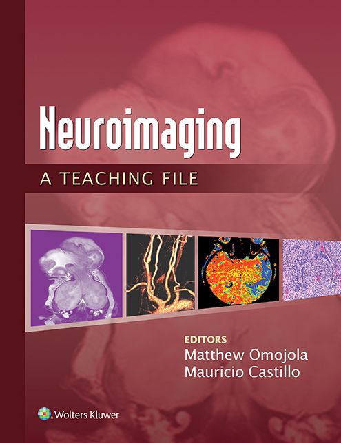 Neuroimaging: A Teaching File: A Teaching File