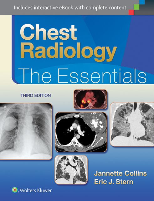 Chest Radiology: The Essentials: The Essentials