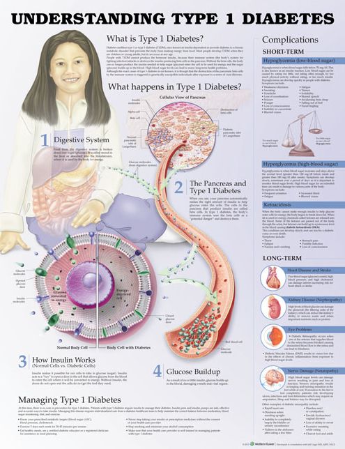 Understanding Type 1 Diabetes Anatomical Chart