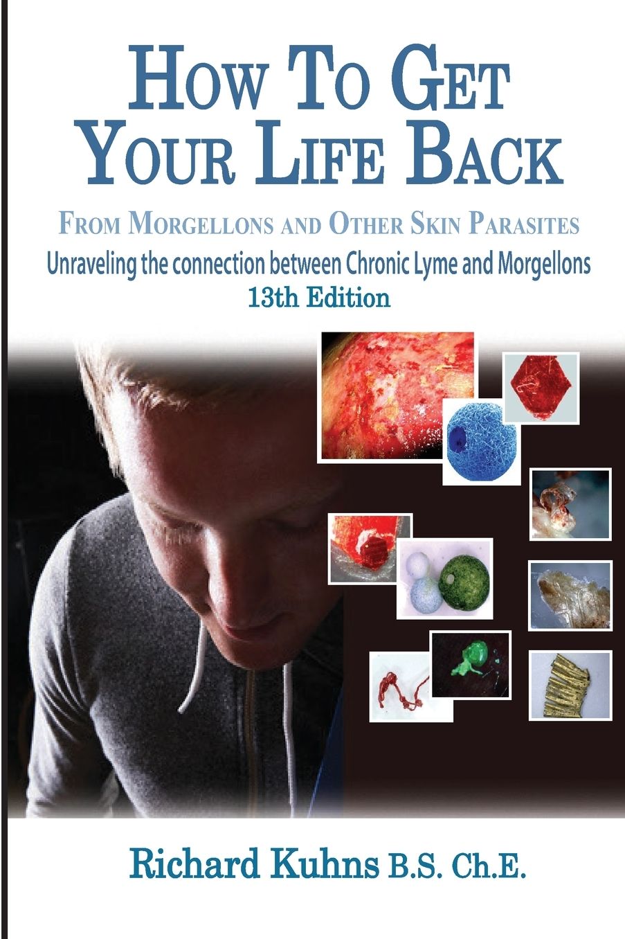 How to Get Your Life Back from Morgellons and Other Skin Parasites Limited Edit