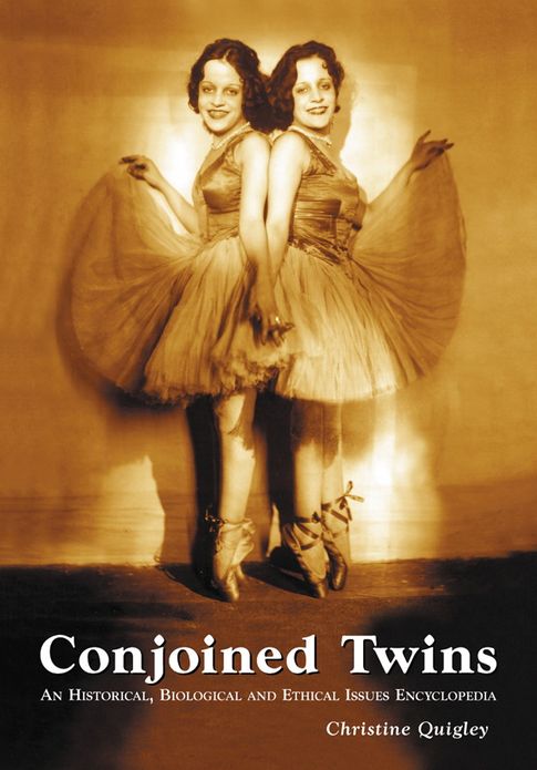 Conjoined Twins: An Historical, Biological and Ethical Issues Encyclopedia