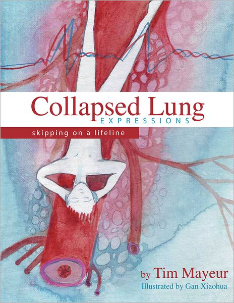 Collapsed Lung Expressions: Skipping on a Lifeline (PagePerfect NOOK Book)