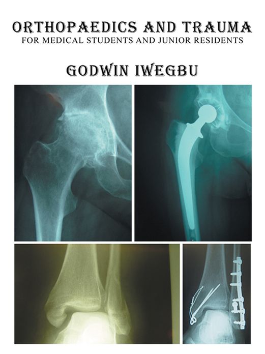 Orthopaedics and Trauma for Medical Students and Junior Residents